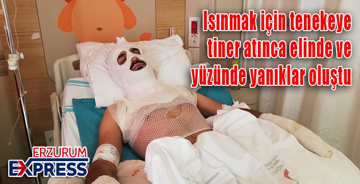 Isınmak için tenekeye tiner atınca elinde ve yüzünde yanıklar oluştu